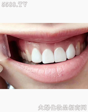 ��������������Ƽ����޹�˾�����(y��ng)������Ӗ(x��n)����