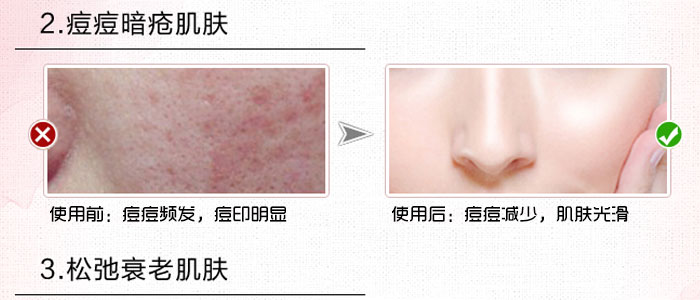 隆麗琦本草潤白修復霜套盒 隆麗琦本草潤白修復霜套盒