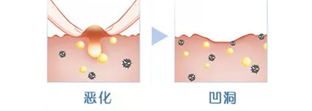 �wʿ�_�����r�������o���ɷ�+�����r�������o��øҺ