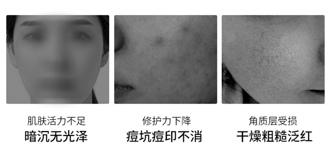 凍干粉套盒 凍干粉套盒