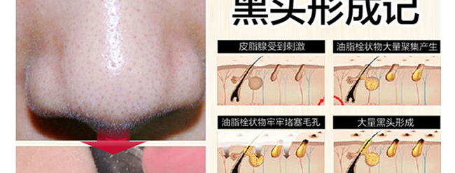 Ԋ��T�^(q��)��̿ȥ���^���b