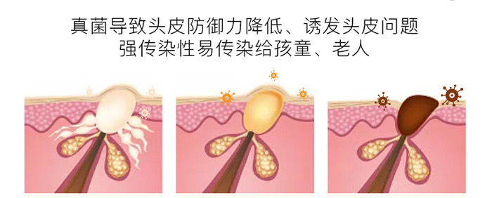 ����ֲ��ȥм����ϴ�l(f��)��