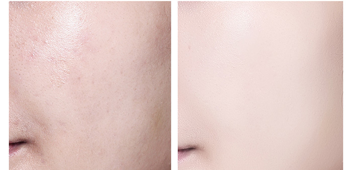 ���ǉ�(m��ng)���˝�(r��n)��BB˪