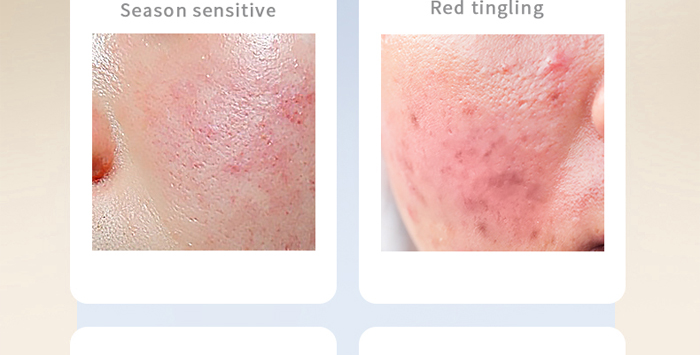 古璟妍舒緩修護乳 古璟妍舒緩修護乳