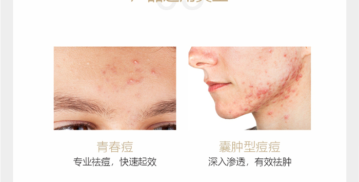 ؐ��ޱԊ(sh��)�������R�����ȡ�С���z��