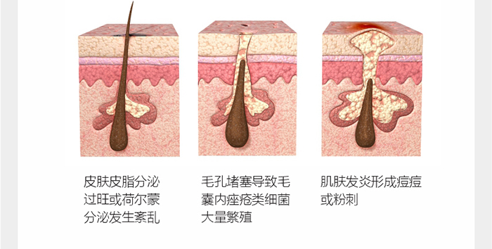 ؐ��ޱԊ(sh��)�������R�����ȡ�С���z��