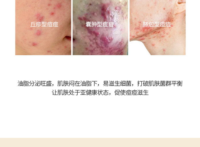 Ԕ��-ֲ��ƽ��ˮ