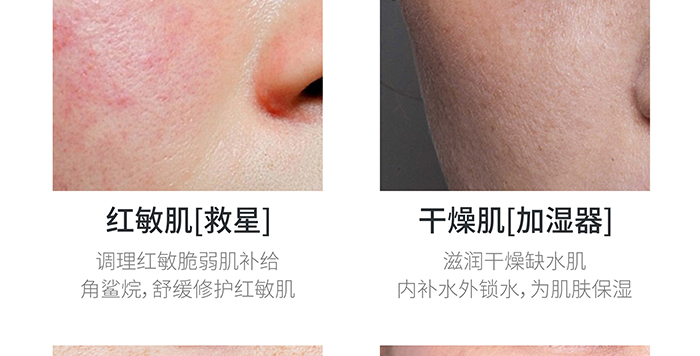 高地保濕修護(hù)霜 高地保濕修護(hù)霜