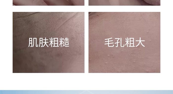 �C��ѩ�w��ĸ���Ŀ���ˮ